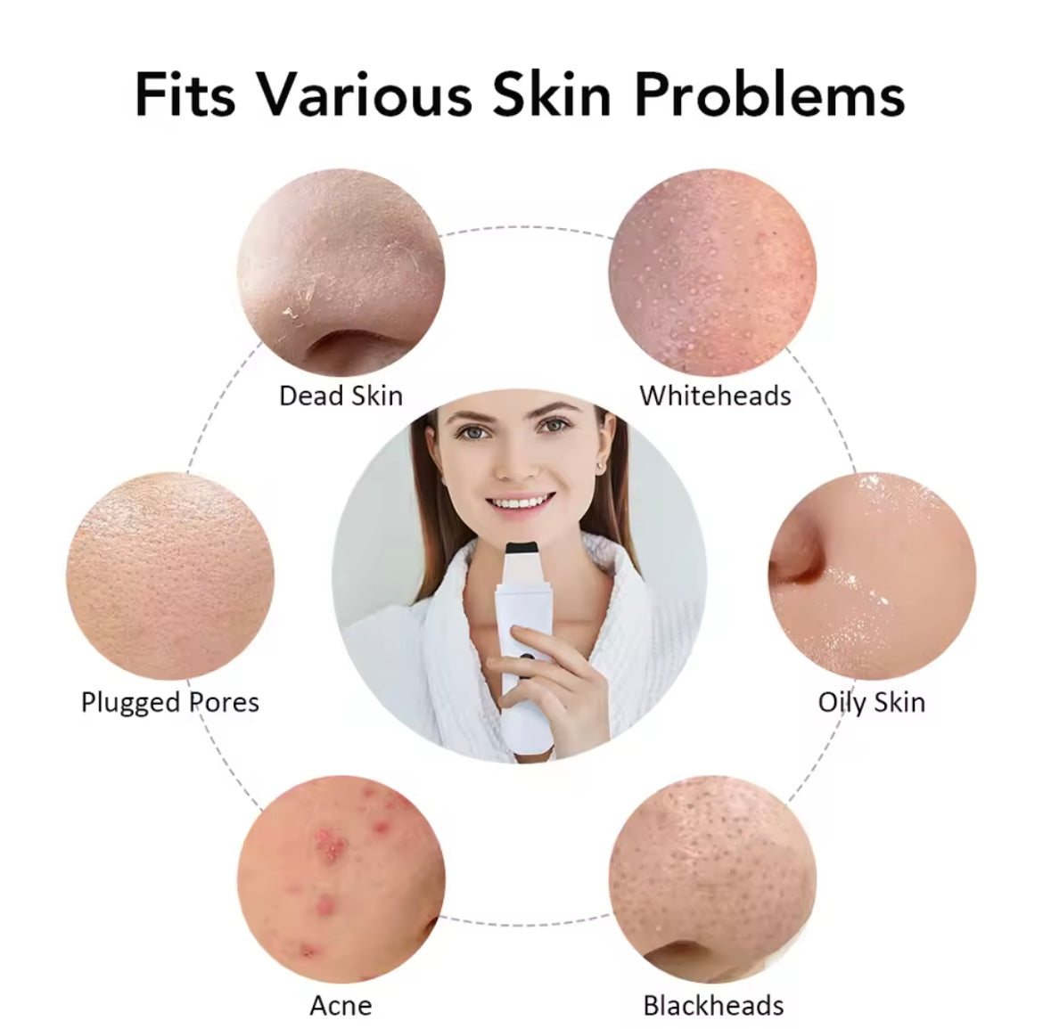 Épurateur de peau à ultrasons – Spatule de nettoyage facial ionique 4 modes – Dispositif de peeling et lifting du visage – Nettoyage en profondeur et soin de la peau